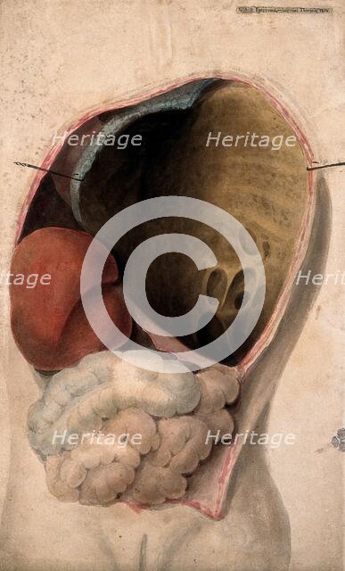 A dissected thorax with a collection of pus in the cavity, c1824. Creator: Unknown.