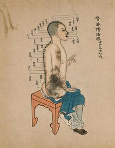 Acupuncture chart with a series of points indicated on the figure of a seated Chinese man, 1700-1799 Creator: Unknown.