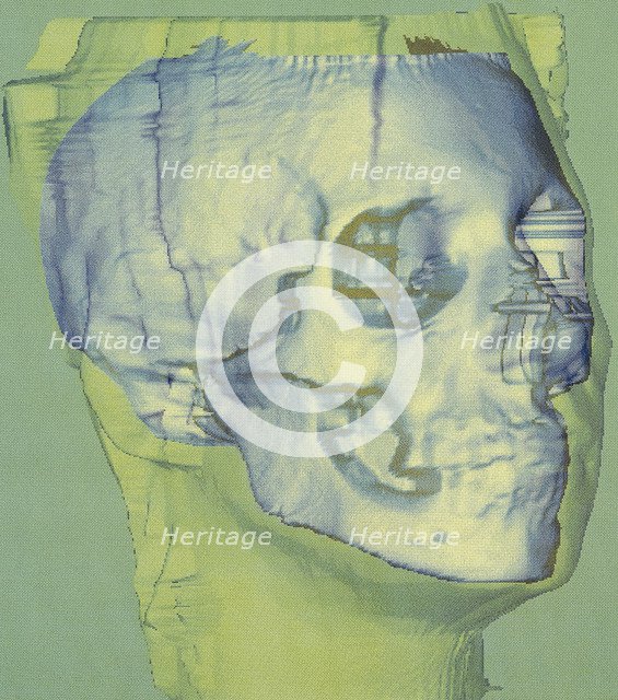 Stages in facial reconstruction of the bathrocranic skull. Artist: Unknown