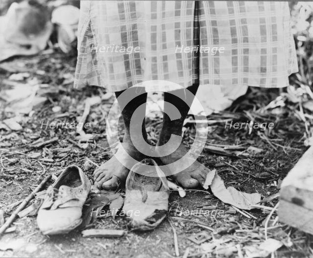 Feet of Negro cotton hoer near Clarksdale, Mississippi, 1937. Creator: Dorothea Lange.