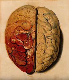Brain: view from above, showing the gyri, with one hemisphere covered with pia mater, 1820-1827. Creator: Unknown.