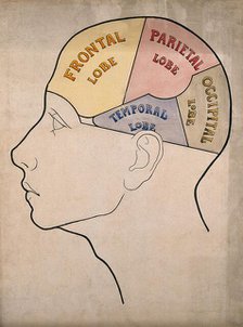 Head of "a backward boy" divided into four cerebral lobes: profile, c1900. Creator: Bernard Hollander.