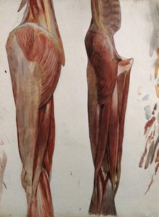 Two dissections showing the muscles of the thigh, hip, pelvis and knee, (1833?). Creator: Johann Conrad Zeller.