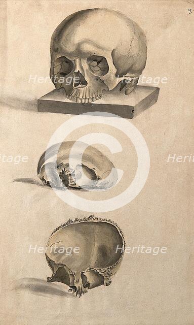 Human skull: three figures showing sections and an entire skull, 1830-1835. Creator: Unknown.