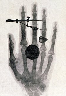 Wilhelm Roentgen's X-ray photograph of his wife's hand, 1896. Artist: Wilhelm Conrad Rontgen