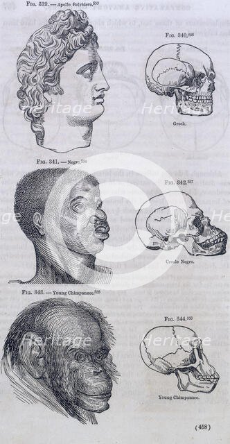 Three faces compared with skulls, 1854. Creator: Unknown.