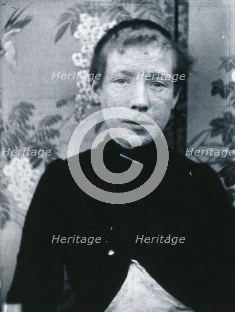 Gloucester smallpox epidemic, 1896: Ethel Cromwell, aged about 14 years, as a smallpox patient, 1896 Creator: HCF of Gloucester.