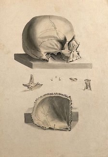Human skull: six figures showing sections and an entire skull, 1830-1835. Creator: Unknown.