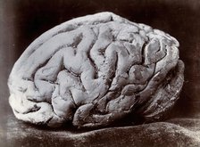 A brain, viewed from the side, supposedly from a subject with mental deficiency. Creator: N. Goulton May.