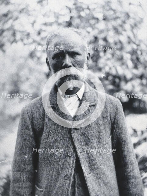 Gloucester smallpox epidemic, 1896: George Steel, a smallpox patient, 1896. Creator: HCF of Gloucester.