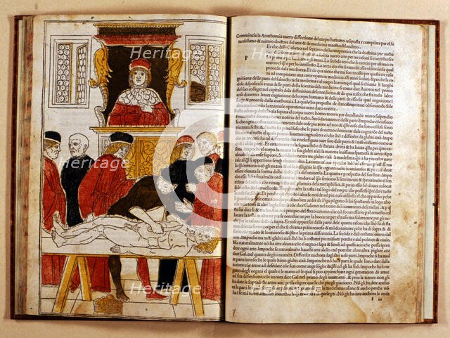 Coloured xilograph that shows for the first time the operation of a corpse dissection, 1493-1494. Creator: Johan Ketham (1415-1470).