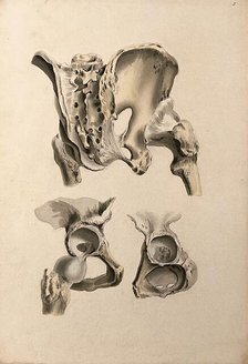 Ligaments of hip-bone and femur (thigh-bone), 1830-1835. Creator: Unknown.
