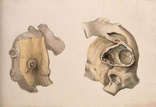 Two diseased parts of the body. Creator: Unknown.