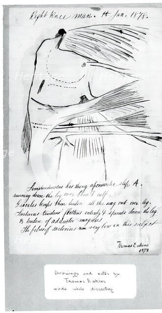 (Untitled) (Anatomical Study Of Right Knee), 1878. Creator: Thomas Eakins.