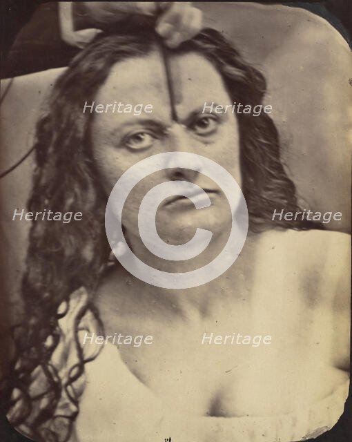 Figure 81: Lady Macbeth, moderate expression of cruelty, 1854-56, printed 1862. Creators: Duchenne de Boulogne, Adrien Alban Tournachon.