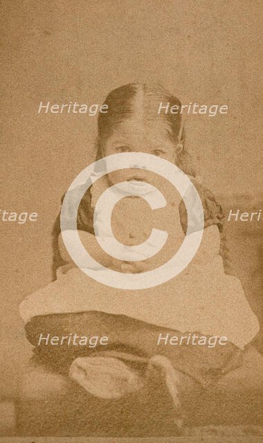 A very young girl, showing signs of mental deficiency, seated with her hands clasped upon her lap. Creator: William Moscrop.