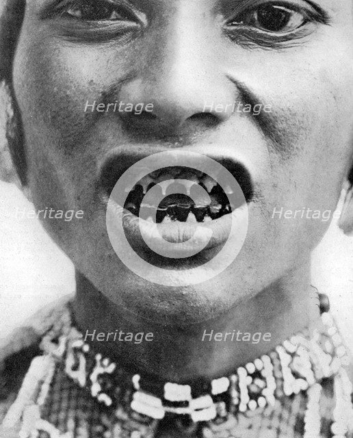 A Bagobo, with filed teeth.Artist: The Bureau of Science