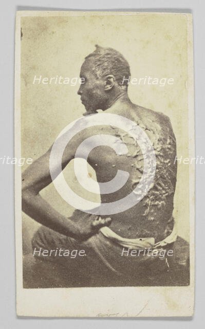 Gordon Under Medical Inspection, 1863. Creator: McPherson & Oliver.