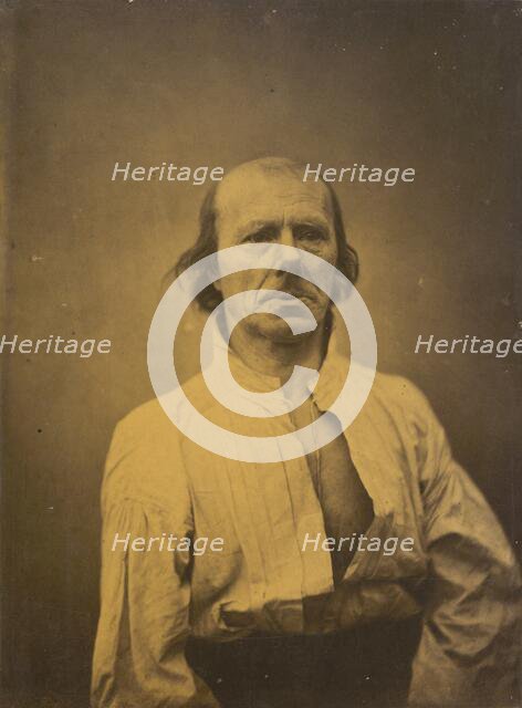 Face in repose, 1854-1856, printed 1862. Creator: Duchenne de Boulogne.