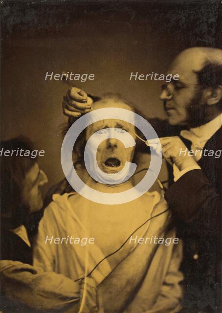 Terror mixed with pain, torture, 1854-1856, printed 1862. Creator: Duchenne de Boulogne.