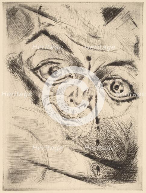 Peter with a Gunshot Wound in His Forehead, 1918. Creator: Walter Gramatté.