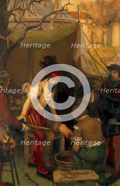 Ambroise Paré using the ligature when amputating at the siege of Damvillers, 1552, c1912. Creator: Ernest Board.