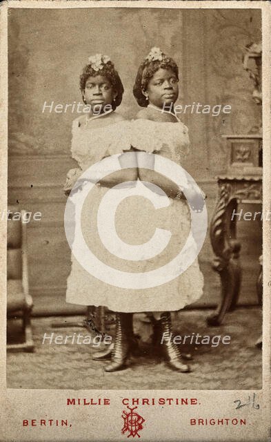 The Millie-Christine sisters, conjoined twins, standing, 1874. Creator: Bertin.