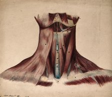 Dissection of the back of the neck, 1854/03/16. Creator: J.C. Whishaw.