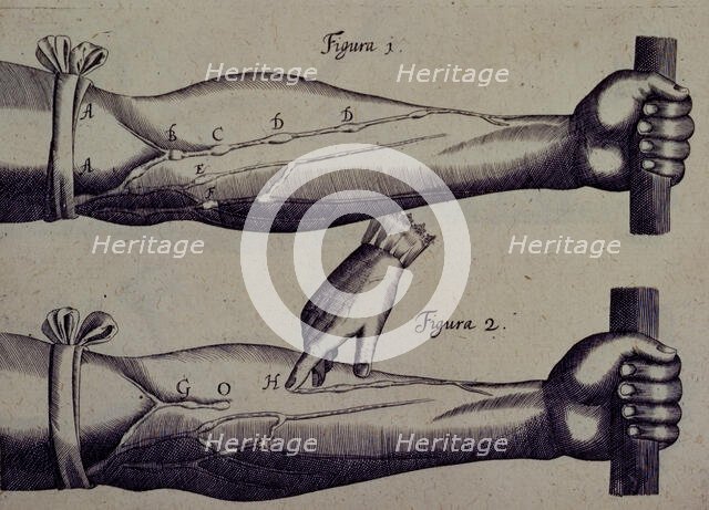 Two arms, and a finger pointing towards a vein, 1628. Creator: Unknown.