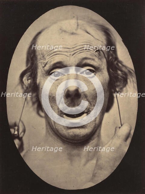 Figure 56: Surprise, 1854-56, printed 1862. Creators: Duchenne de Boulogne, Adrien Alban Tournachon.