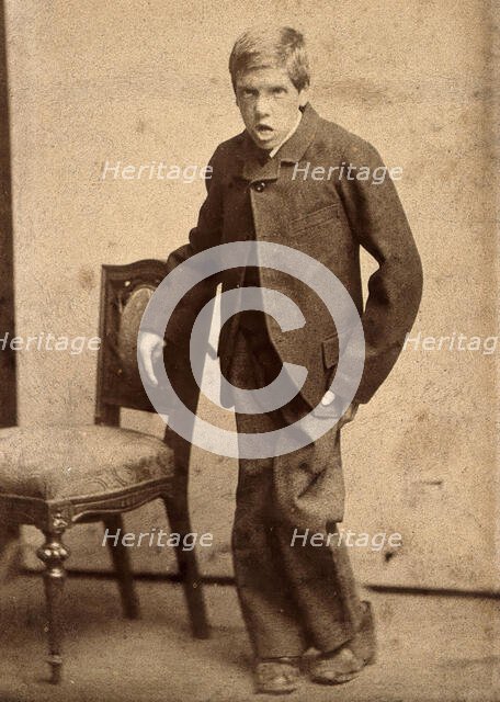 A young man, showing signs of mental deficiency, leaning awkwardly..., c1890s. Creator: Davis.