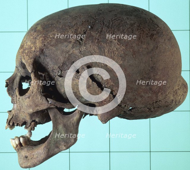 Stages in facial reconstruction of the bathrocranic skull. Artist: Unknown