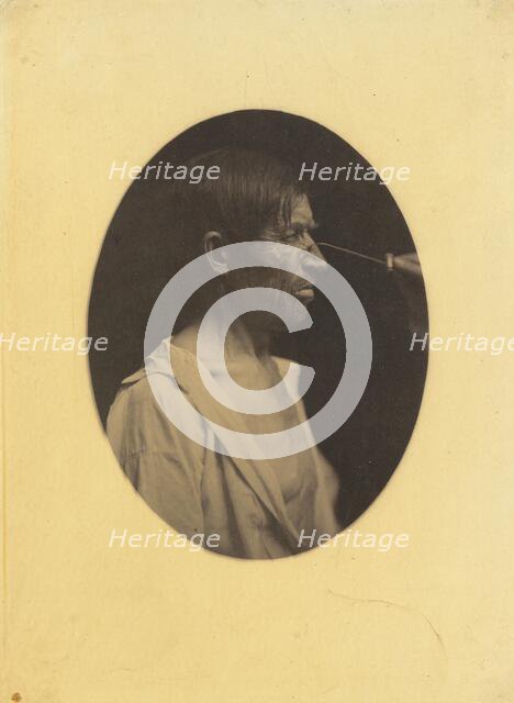 Bad humor, malcontentment, 1854-1856, printed 1862. Creator: Duchenne de Boulogne.