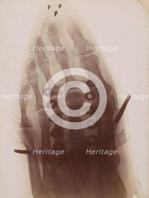 Le pied à travers la chaussure, 1896. Creator: Henri van Heurck.