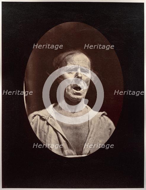 Figure 54: Abaissement volontaire de la mâchoire inférieure: mouvement inexpressif, c. 1856. Creator: Guillaume-Benjamin-Amand Duchenne (de Boulogne) (French, 1806-1875); Adrien Tournachon (French, 1825-1903).