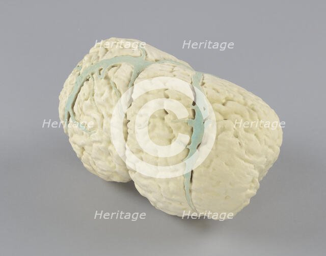 Model of the conjoined brains of Ladan and Laleh Bijani used by Dr. Ben Carson, 2003. Creator: Unknown.