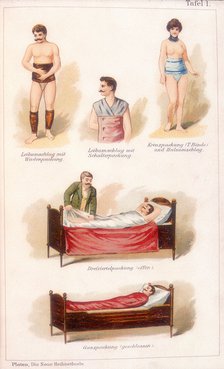 Hydrotherapy treatments, c1902. Artist: Unknown