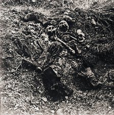 Human remains, c1914-c1918. Artist: Unknown.