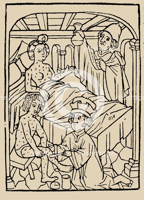 Syphilis treatment: Treatment with ointments (mercury). From: A Malafranczos morbo gallorum preserv