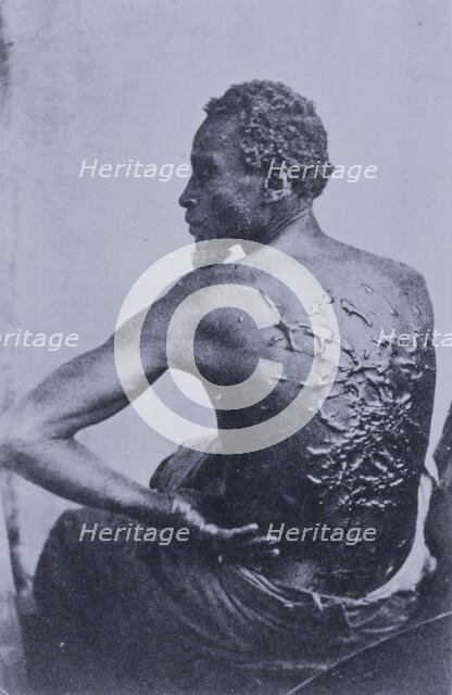 The Scourged Back- The furrowed and scarred back of Gordon, a slave who escaped..., Louisiana, 1863. Creators: Unknown, C. Seaver, Jr..