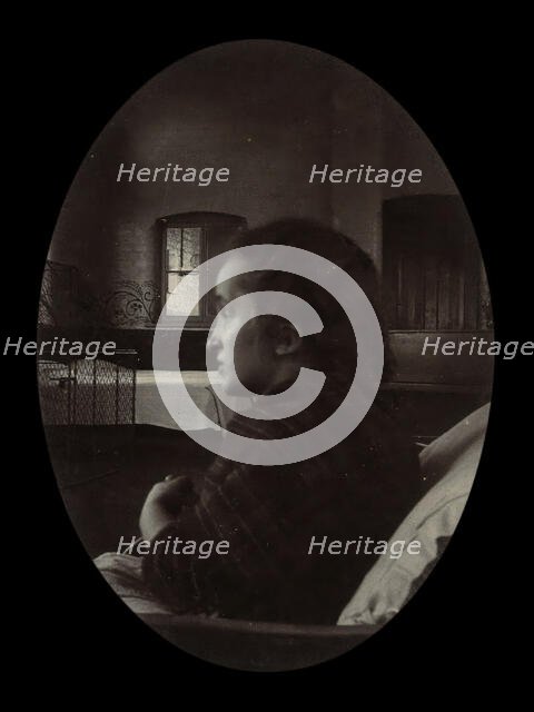 Side profile of a young woman with a misshapen head, wrapped in a tartan shawl, probably... Creator: Unknown.