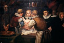 Surgeons performing an operation on a woman's breast in the seventeenth century. Creator: Unknown.