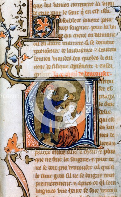 Cupping, 14th century. Artist: Unknown