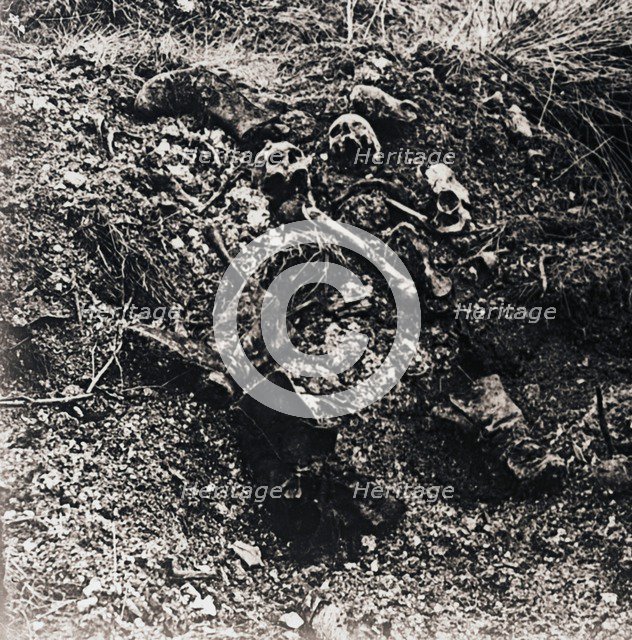 Human remains, c1914-c1918. Artist: Unknown.