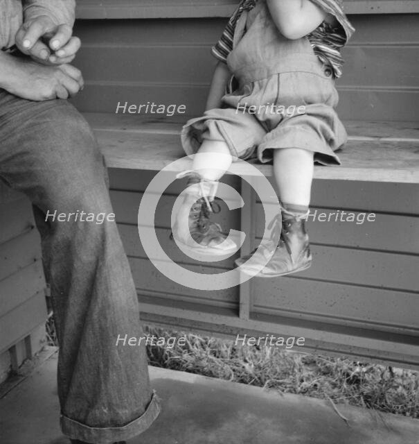 Baby with club feet wearing homemade splints, FSA camp, Tulare County, California, 1939. Creator: Dorothea Lange.
