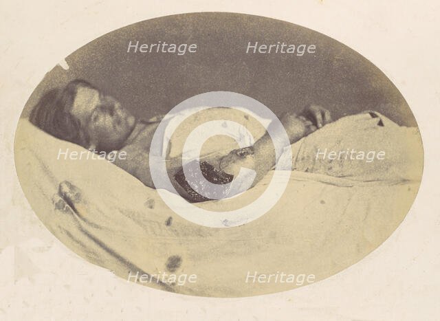 Frederick Pilgrim, 1865. Creator: Reed Brockway Bontecou.