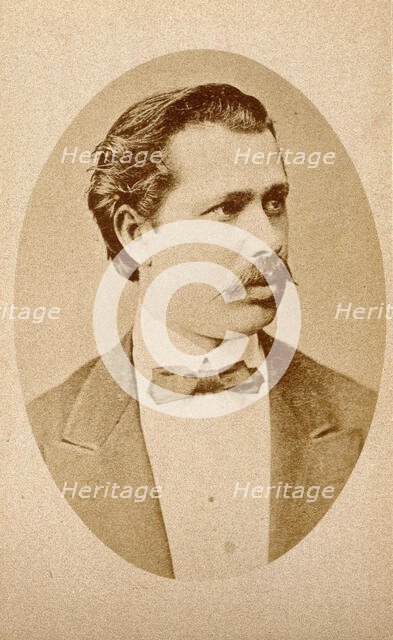 Photograph of Johann Schnitzler. Creator: Unknown.