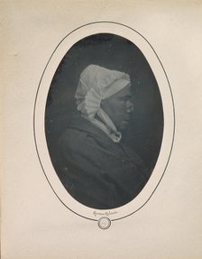 [Profile of a Woman with Necrosis of the Nose], 1841-48. Creator: Louis-Auguste Bisson.
