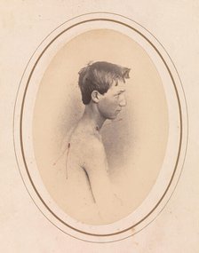 Private Jacob F. Simmons, Company H, Eighty-second Pennsylvania Volunteers, April-May 1865. Creator: Reed Brockway Bontecou.