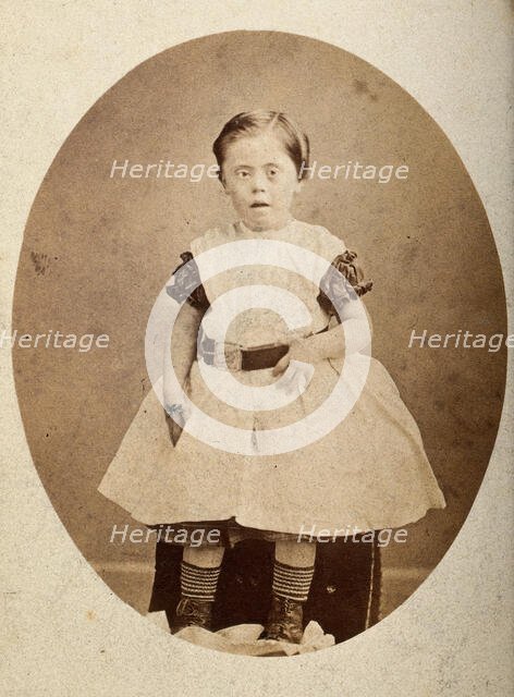 A girl with Down's syndrome, sitting, wearing striped socks, c1890s. Creator: Joseph Arthur Baldry.